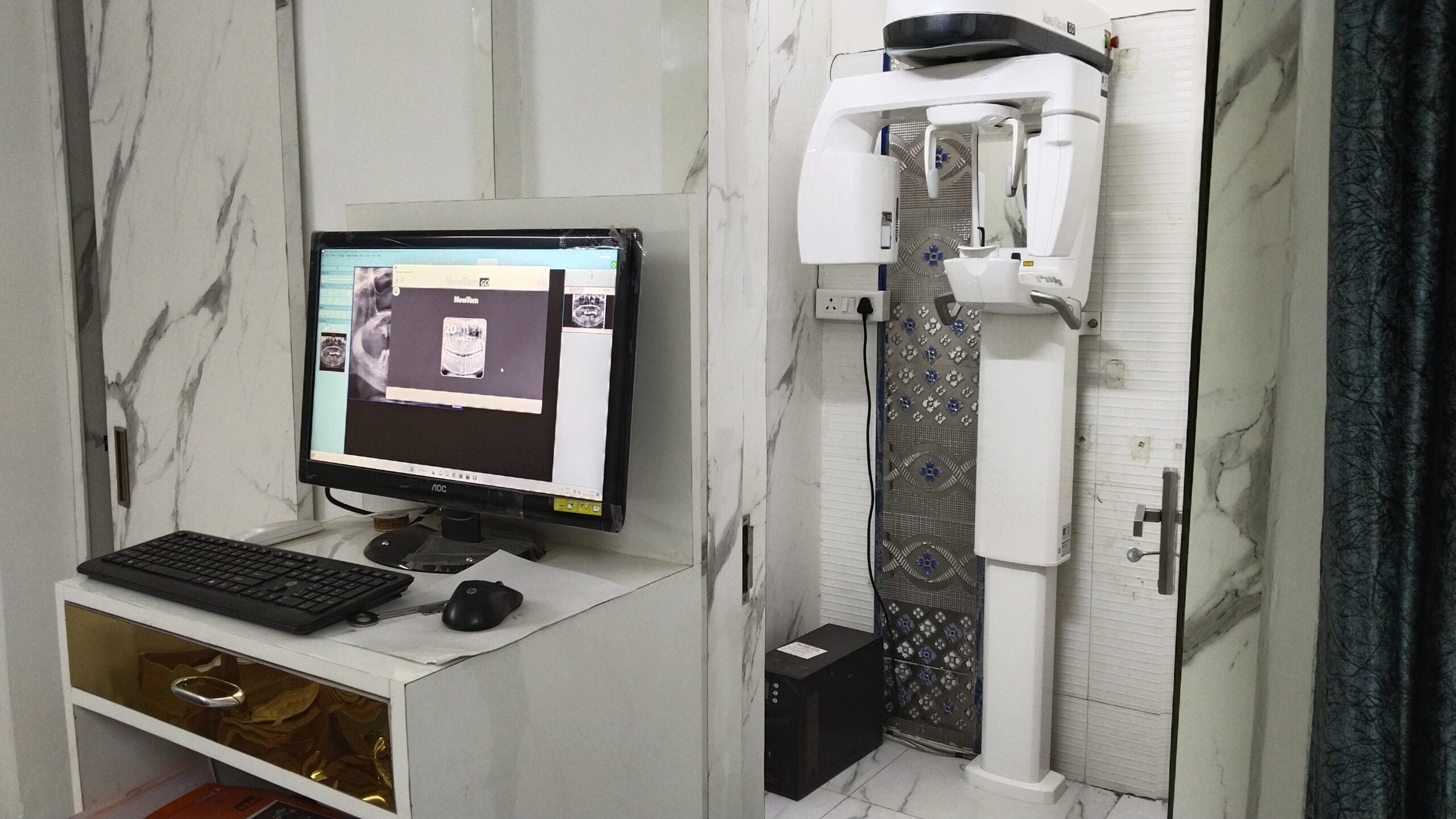 Complete View of Opg X-Ray Machine