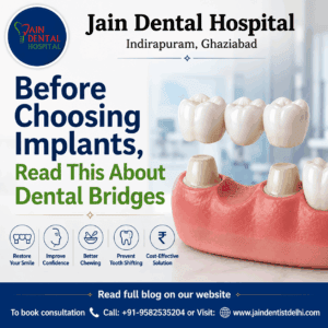 Dental Bridges A Comprehensive Guide to Types, Procedures, and Care