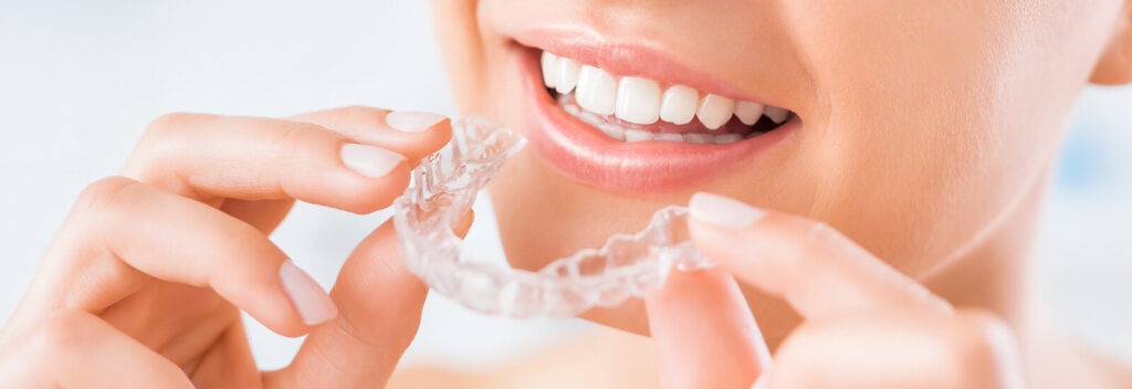 Feature image of Clear Teeth Aligners, Invisible Braces blog post