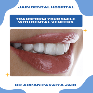 Patient smile enhanced with dental veneers treatment in Delhi NCR clinic