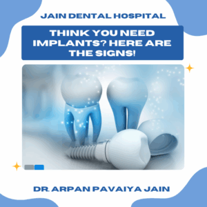 Think You Need Dental Implants