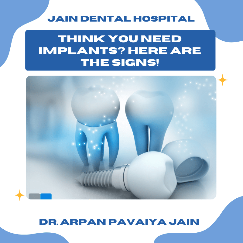 Think You Need Dental Implants