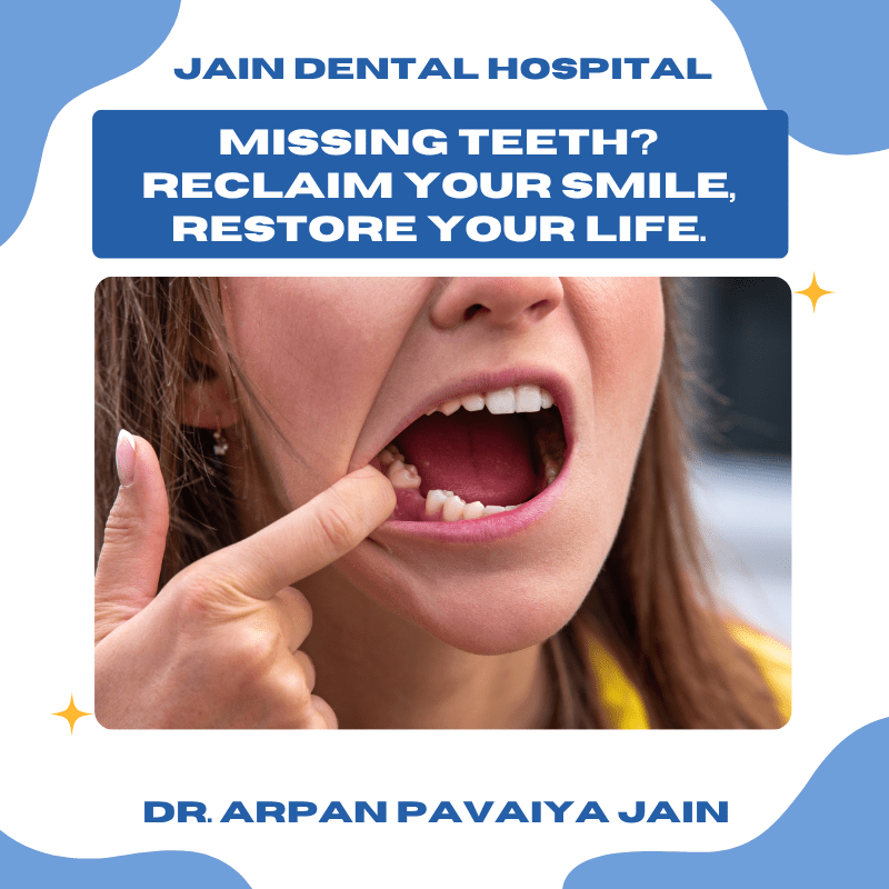 missing-teeth-problems-and-treatment-option