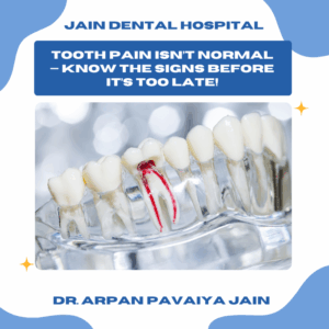 visual representation of signs you may need a root canal treatment, such as swelling or sensitivity.