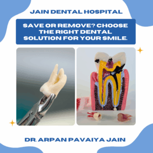 Comparison between root canal treatment and tooth extraction – dental procedures explained for patients