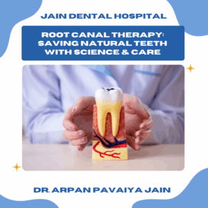 Illustration of root canal therapy showing how dental science helps save natural teeth
