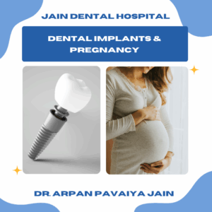 Illustration showing the connection between dental implants and pregnancy safety.