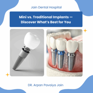 Comparison of mini dental implants and traditional dental implants showing key differences in size, structure, and purpose.