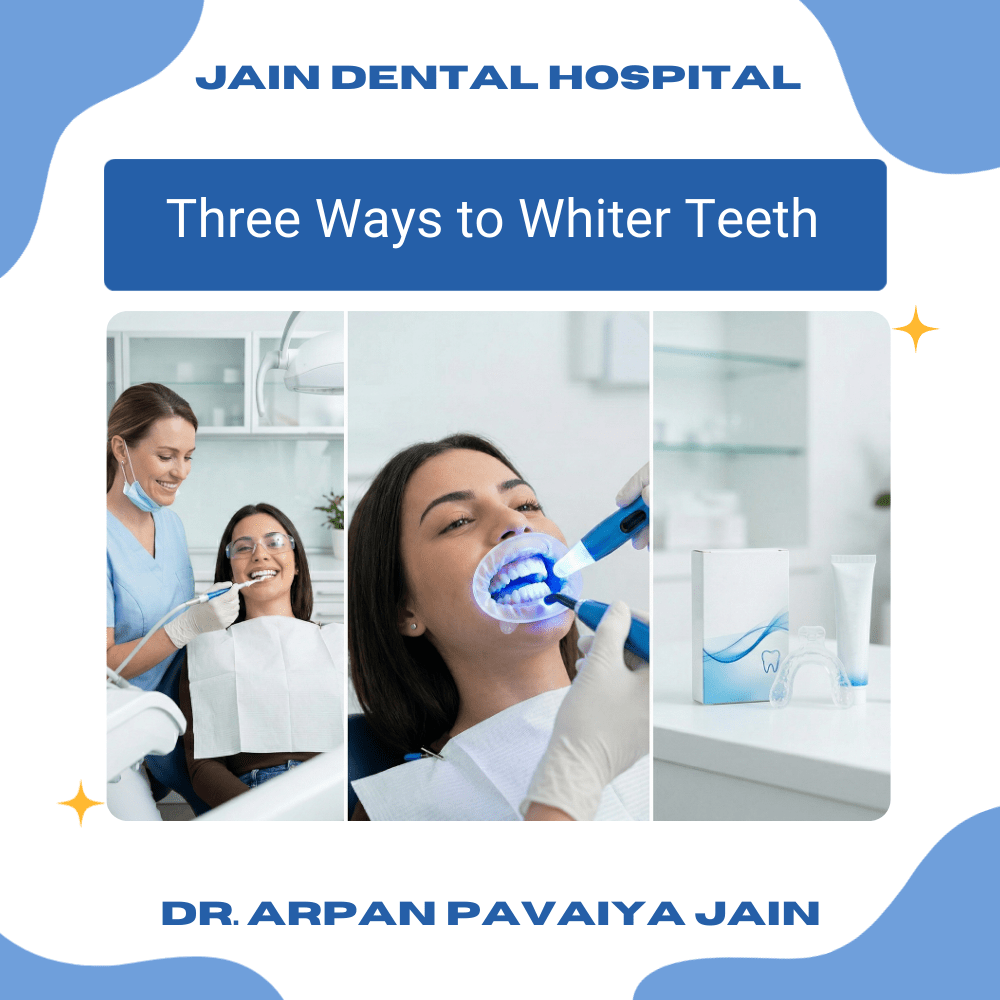 Comparison of professional, laser and at-home teeth whitening treatments