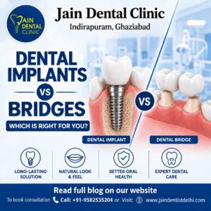 Dental implants vs dental bridges comparison graphic by Jain Dental clinic Indirapuram Ghaziabad showing tooth replacement options for missing teeth patients in Delhi NCR.