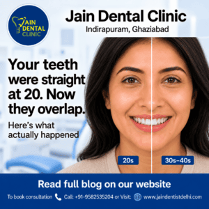 Showing a woman’s straight teeth in her 20s compared with overlapping teeth in her 30s–40s, illustrating how teeth can gradually shift and become crowded with age.