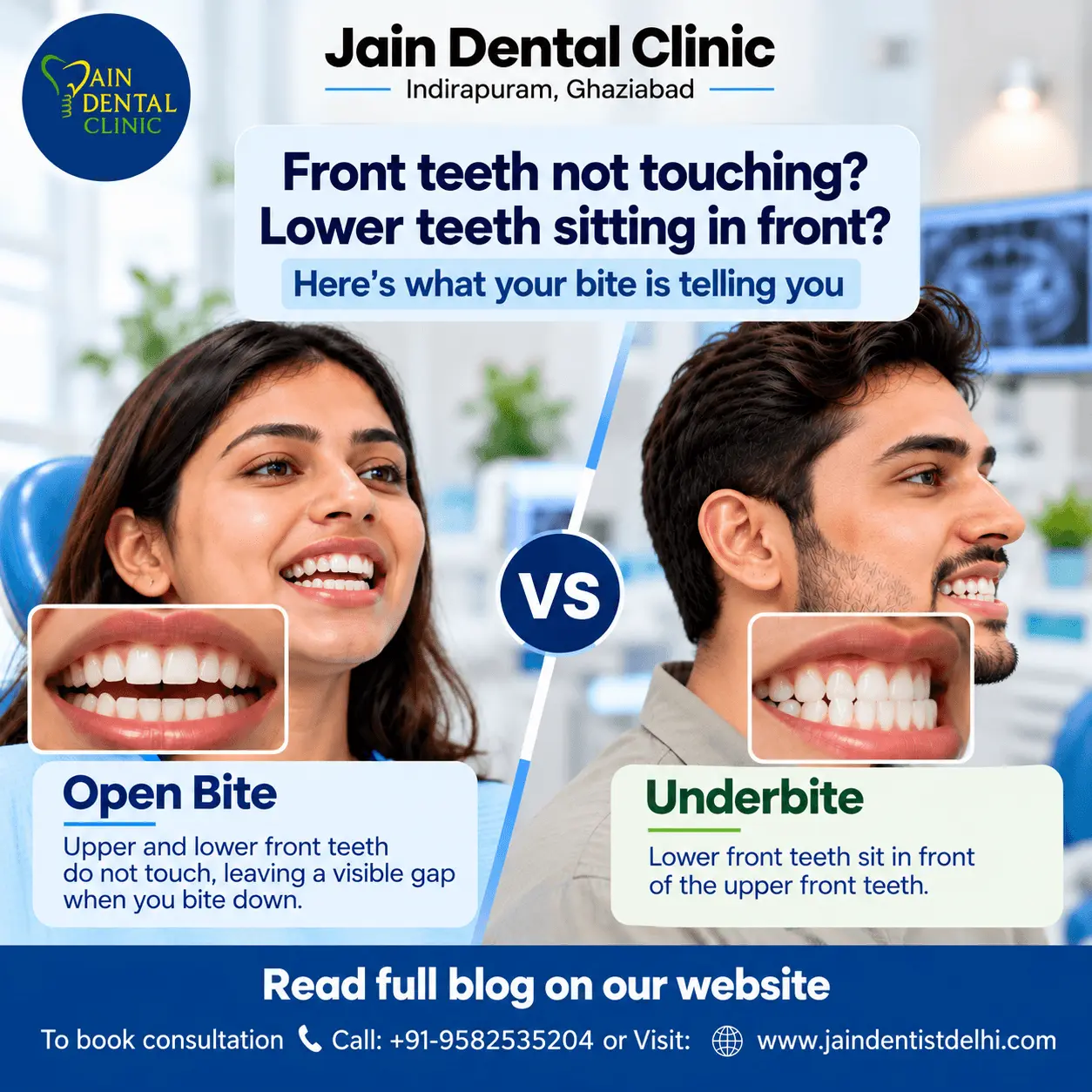 Open bite vs underbite comparison from Jain Dental Clinic: a gap between the front teeth vs lower teeth sitting in front